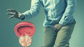 Akūts prostatīts
